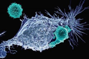 Image of mesothelin-specific CAR T cells attacking a cancer cell